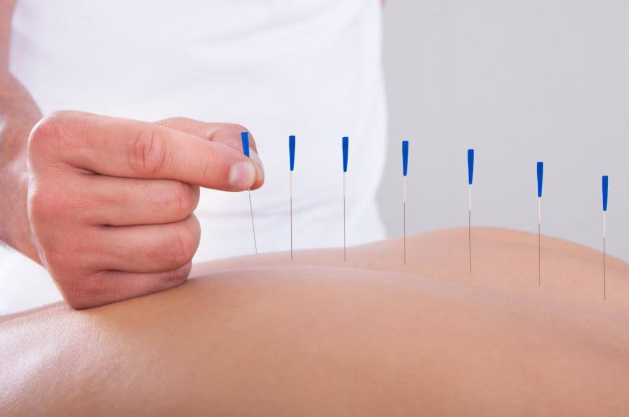 Acupuncture: Purpose, Benefits, Side Effects, Cost, Time to Work