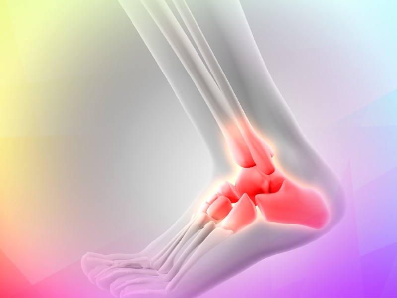 Osteochondral Allograft for Ankle Cartilage Defects