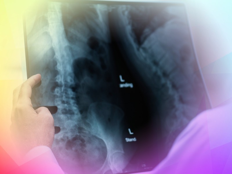 When supraspinatus tendinopathy needs imaging