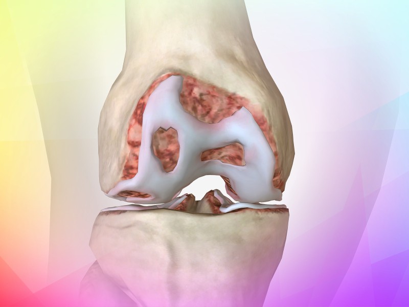 ChondroFiller™ durability compared with Arthrosamid