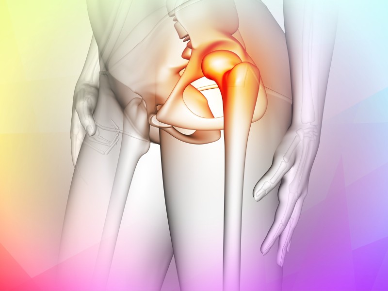 Early signs of hip osteoarthritis