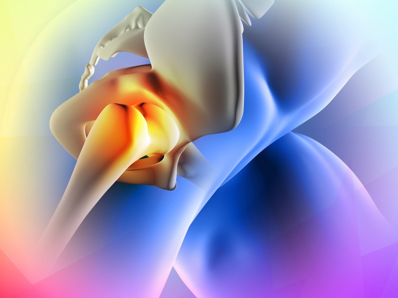 Ultrasound-Guided ChondroFiller for Hip Cartilage Defects