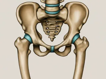 Patient Impact: How Radiology Findings Influence Hip Osteoarthritis Prognosis