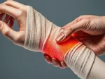 Common Causes of Wrist Sprains and How to Avoid Them