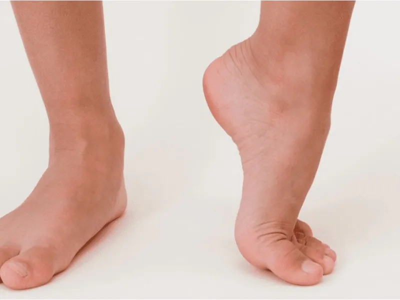 Lisfranc Joint Pain: Symptoms, Causes, Recovery Treatment