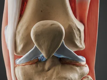Preventing Plica Syndrome: Tips for Knee Health
