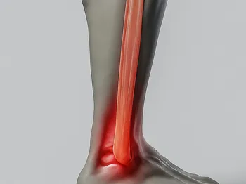 Understanding the Main Causes of Achilles Tendon Pain: What Triggers The Discomfort?