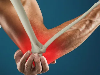 Comprehensive Guide to Tennis Elbow: Diagnosis, Recovery, and Prevention