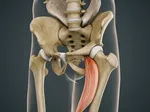 Identifying Iliopsoas Bursitis: Symptoms and Diagnosis