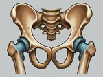 Understanding Hip Impingement: Causes, Symptoms, and Recovery