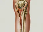 Rehabilitation After a Tibia Plateau Fracture: What to Expect