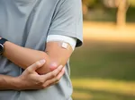 Understanding Elbow Fractures: Causes, Symptoms, and Diagnosis