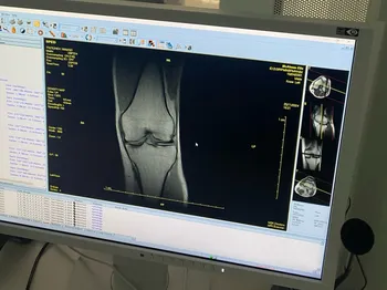 Harnessing AI for Transformative Musculoskeletal Healthcare: The onMRI Breakthrough