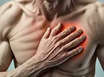 Costochondritis: Symptoms, Causes, Treatment, Exercises