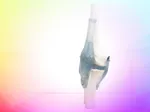 Cartilage repair or knee replacement