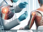 Platelet-Rich Plasma (PRP) Therapy for Shoulder Injuries: Efficacy and Recovery Time