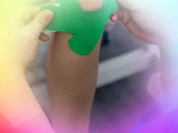 OATS or microfracture for active knee patients