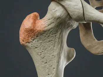 Comprehensive Care for Labral Tears of the Hip: Expertise in Sports Medicine and Orthopaedics