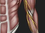 Comprehensive Guide to Ulnar Nerve Compression and Cubital Tunnel Syndrome