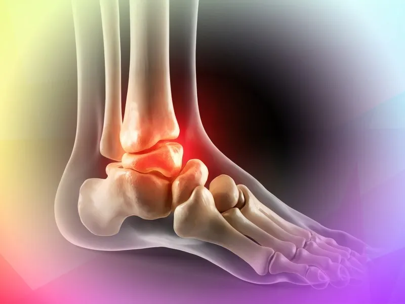 When OATS mosaicplasty beats other ankle cartilage repairs
