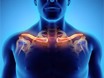 Collarbone Joint Pain: Symptoms, Causes, Recovery Treatment