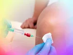 ChondroFiller for focal knee defects, not osteoarthritis