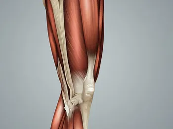 The VMO Muscle: Your Knee’s Hidden Protector