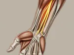 Understanding Carpal Tunnel Syndrome: Causes and Risk Factors
