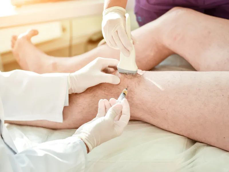 Chondroitin Injections: A Pathway to Enhance Patient Mobility