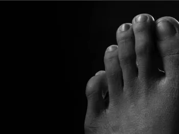 Big Toe Pain: Symptoms, Causes, Treatment & Exercises