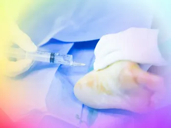 ChondroFiller injection for ankle cartilage defects