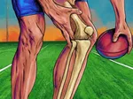 Cartilage Injuries in Young Athletes: Why Early Action Matters