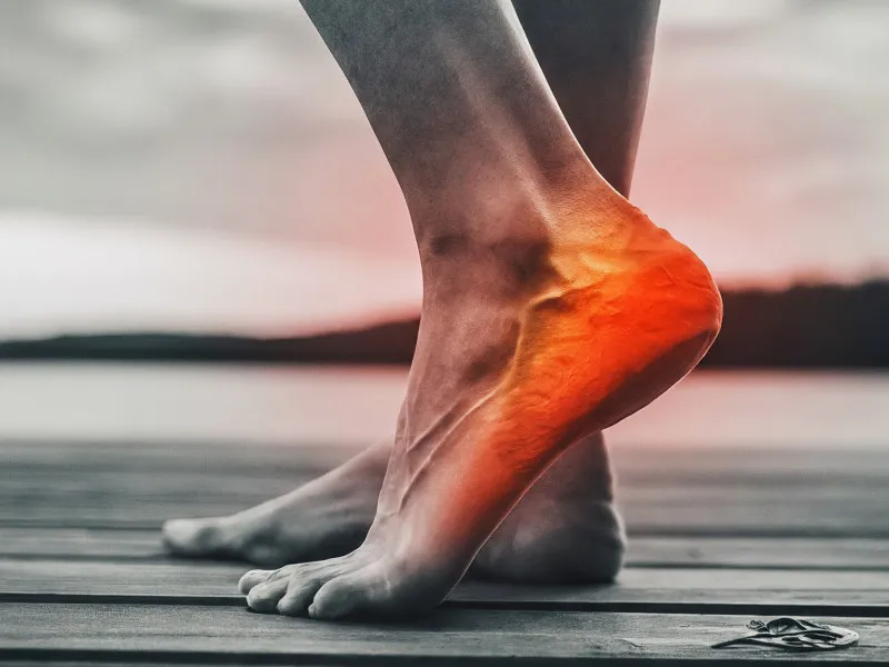 Lifestyle Adjustments to Minimize the Risk of Developing Plantar Fasciitis