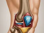 Understanding the Early Warning Signs of Knee Cartilage Damage