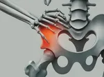 Preventing Hip Arthritis: Tips for Maintaining Joint Health