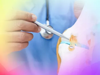 Cartilage Specialist or General Orthopaedic Surgeon