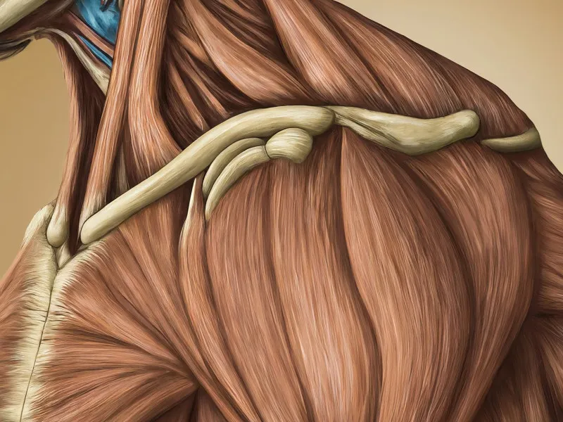 Long-term Management of Subacromial Bursitis: A Comprehensive Guide