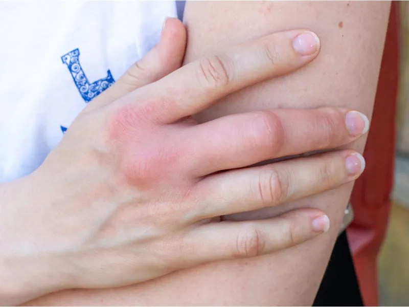 Finger Joint Pain: Symptoms, Causes, Treatment & Exercises