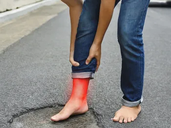 Medial Malleolus Fracture: Causes and the Road to Recovery