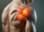 Shoulder Impingement Syndrome: What It Is and How to Fix It