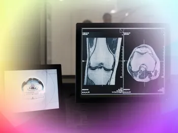 ChondroFiller IKDC and MOCART scores