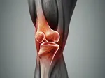 Identifying PCL Injury Symptoms for Timely Intervention