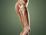 Natural Remedies for Managing Gluteal Tendinopathy Pain