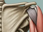 Preventing and Treating Supraspinatus Tendinopathy: A Complete Overview