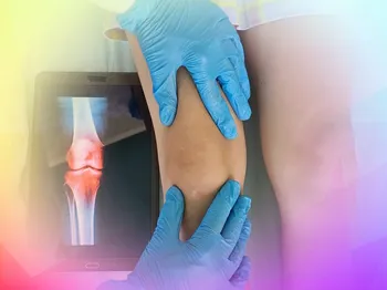 Allograft or Autograft for Large Knee Cartilage Defects
