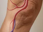 How to encourage lymphatic drainage after knee replacement