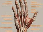 De Quervains Tenosynovitis