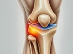 Understanding Cartilage: From Diagnosis to Recovery