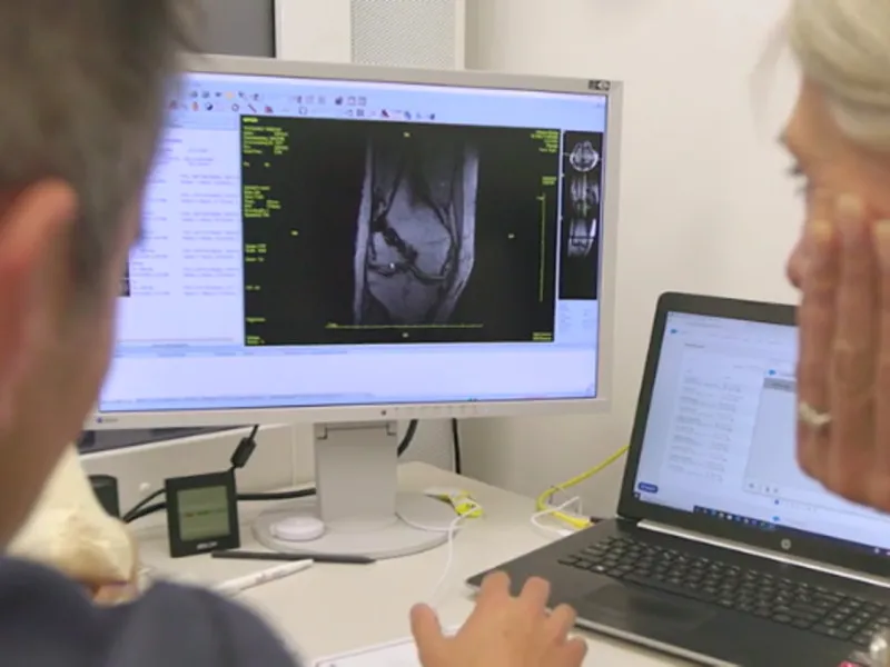 Arthrosamid Injection Reviews & UK Patient Stories