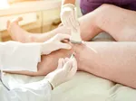Chondroitin Injections: A Pathway to Enhance Patient Mobility